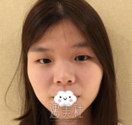 武汉亚太程晓林案例：宛如天生才是自然~ width=