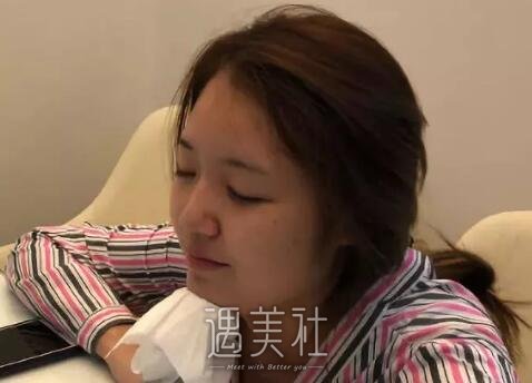 八大处王克明隆鼻案例|就此改变人生!