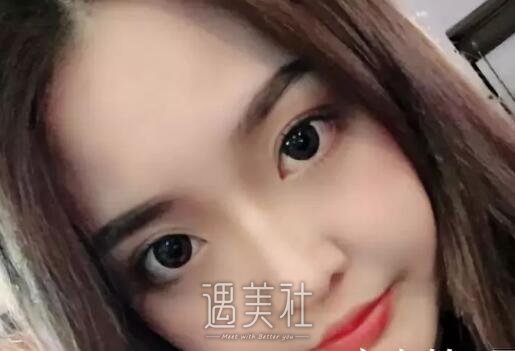 八大处王克明隆鼻案例|就此改变人生!