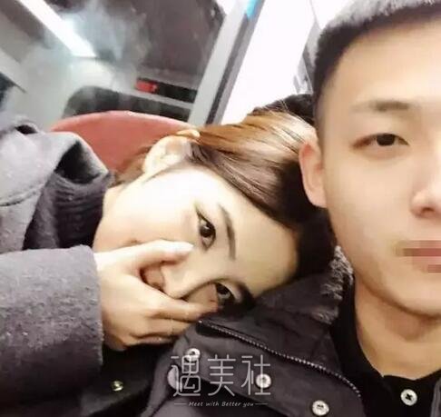 刘志刚,隆鼻