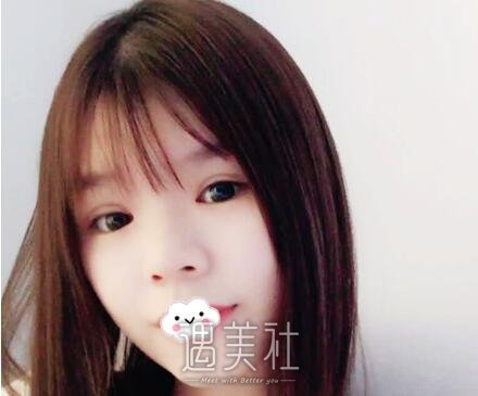 刘育凤