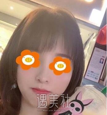 南京,李俊,隆鼻