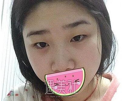 秦宏智