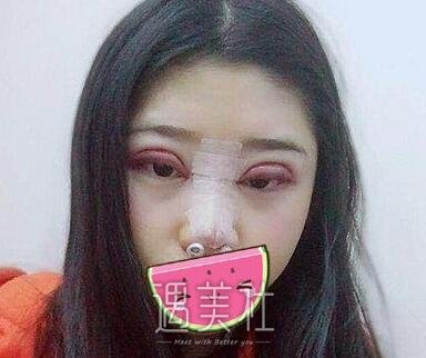 秦宏智