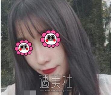 师俊莉,隆鼻