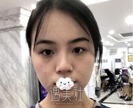 苏薇洁
