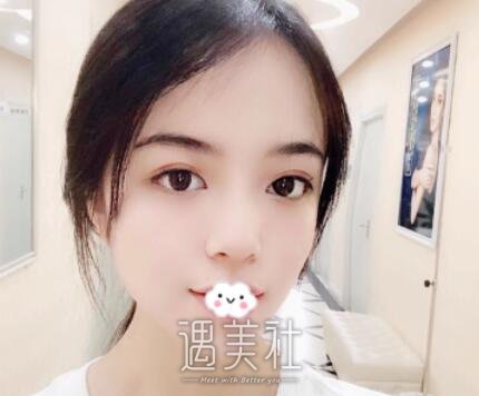 苏薇洁