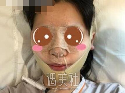 上海,九院,王健,隆鼻