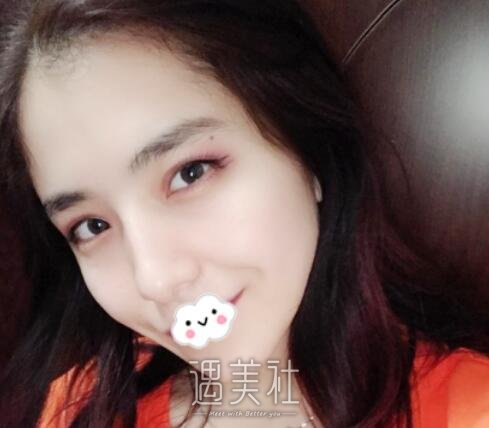 唐振利,隆鼻