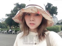 石家庄美联臣整形医院双眼皮案例|原来果这么好! width=
