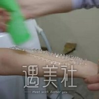 上海九院激光脱毛案例|终于能穿清凉的衣服了!