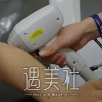 上海九院激光脱毛案例|终于能穿清凉的衣服了!