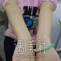 上海九院激光脱毛案例|终于能穿清凉的衣服了!