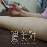 上海九院激光脱毛案例|终于能穿清凉的衣服了!