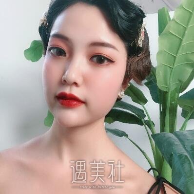 埋线双眼皮案例及对比图分享，前后变化真的很大!