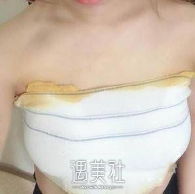 北京润美王明利丰胸案例|男神眼神都变了!