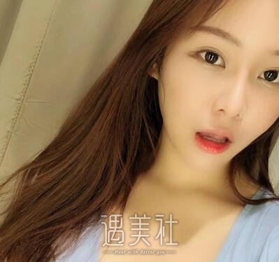 北京润美王明利丰胸案例|男神眼神都变了!