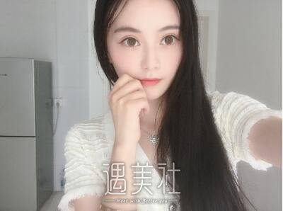 孙玮骏埋线提升案例|变美再也不是梦!