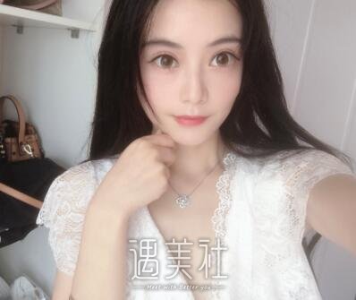 孙玮骏埋线提升案例|变美再也不是梦!