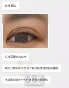 呦嗬？这个神奇的双眼皮术，真相竟然是这样？ width=