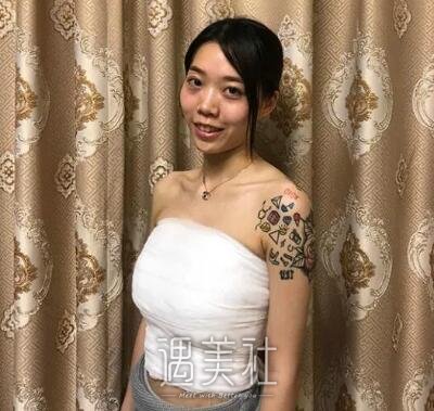 北京京韩乔爱军自体脂肪丰胸案例|弥补了身体缺陷!