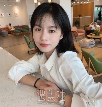 海医悦美常冬青隆鼻案例|果较为满意!