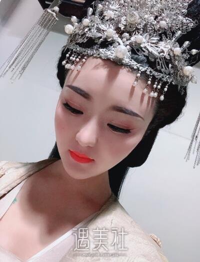 海医悦美林勇隆鼻案例|颜值真的很重要!