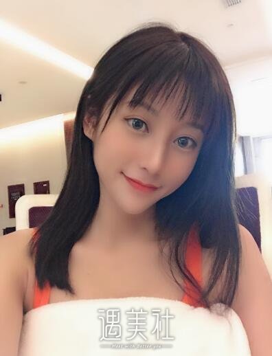 北京美莱欧阳春隆鼻案例|果超出了预期!