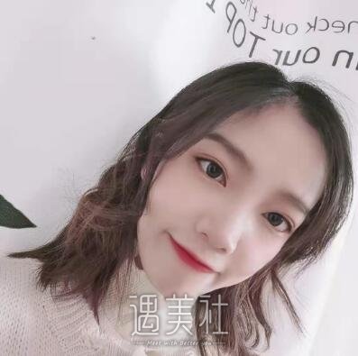 王振军双眼皮修复案例|重新恢复状态!
