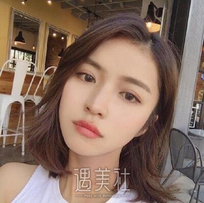 周长兵双眼皮修复案例|精气神瞬间得到改变!