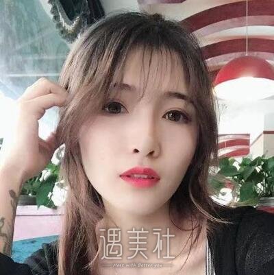 祝联双眼皮修复案例|年轻、漂亮、美美哒!