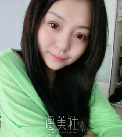 北京润美周明书双眼皮案例|寝室较亮的崽!
