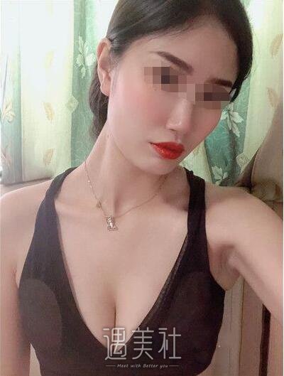 北京润美王明利丰胸案例|眼睛都看直了!