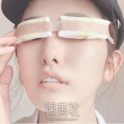 韩勋双眼皮案例|男神终于和我在一起了!