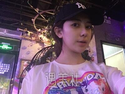 田秋梅隆鼻案例|就此告别糟糕人生!