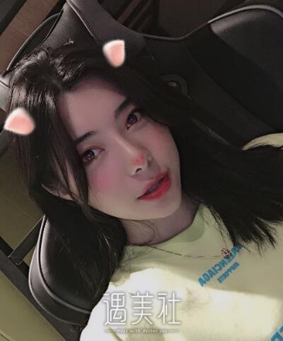 田秋梅隆鼻案例|就此告别糟糕人生!