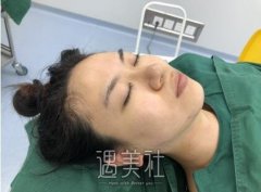 中日友好高占巍磨骨案例展示|医生技术很重要! width=