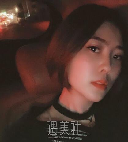 中日友好胡晓根腋臭去除案例|终于有人接近我了!