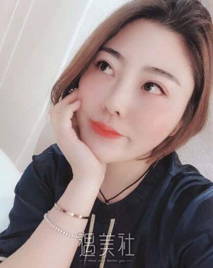 中日友好胡晓根腋臭去除案例|终于有人接近我了!