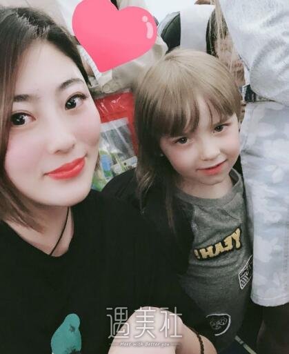 中日友好胡晓根腋臭去除案例|终于有人接近我了!