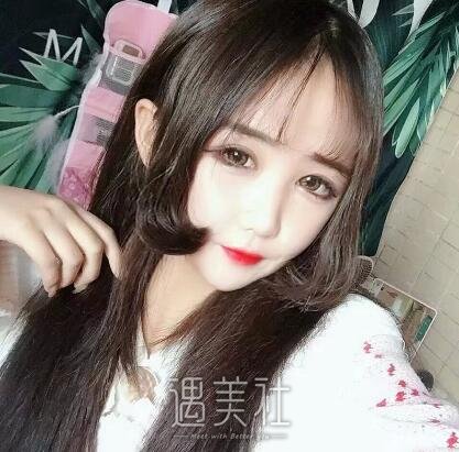 中日友好胡晓根双眼皮案例|焕然一新的感觉!