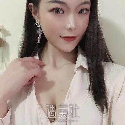 北京京韩王沛森自体脂肪隆胸案例|手感好真实!
