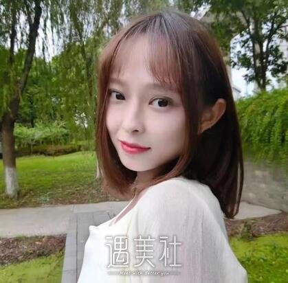 海医悦美林勇双眼皮案例|果真的很不错!