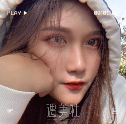 北京美莱杜园园双眼皮案例|人生出现了变化!