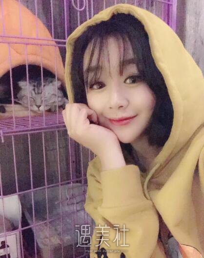 北京美莱曹士华面部脂肪填充案例|看起来更加丰润了!