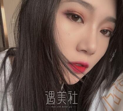 北京美莱欧阳春隆鼻案例|成功想要状态!