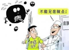上海九院点痣价目表有吗？贵吗？ width=