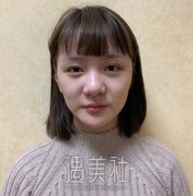 八大处周栩隆鼻案例图：靠谱的医生比什么都有重要~ width=