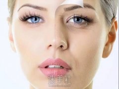 重庆除皱手术多少钱？ width=