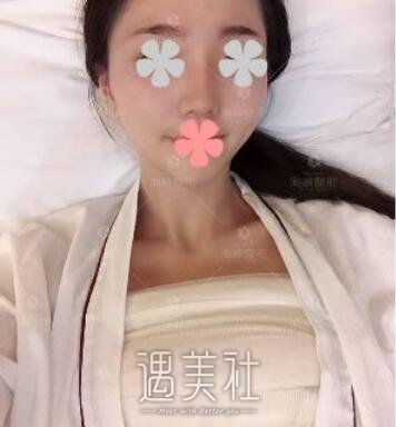 林沸腾,隆胸